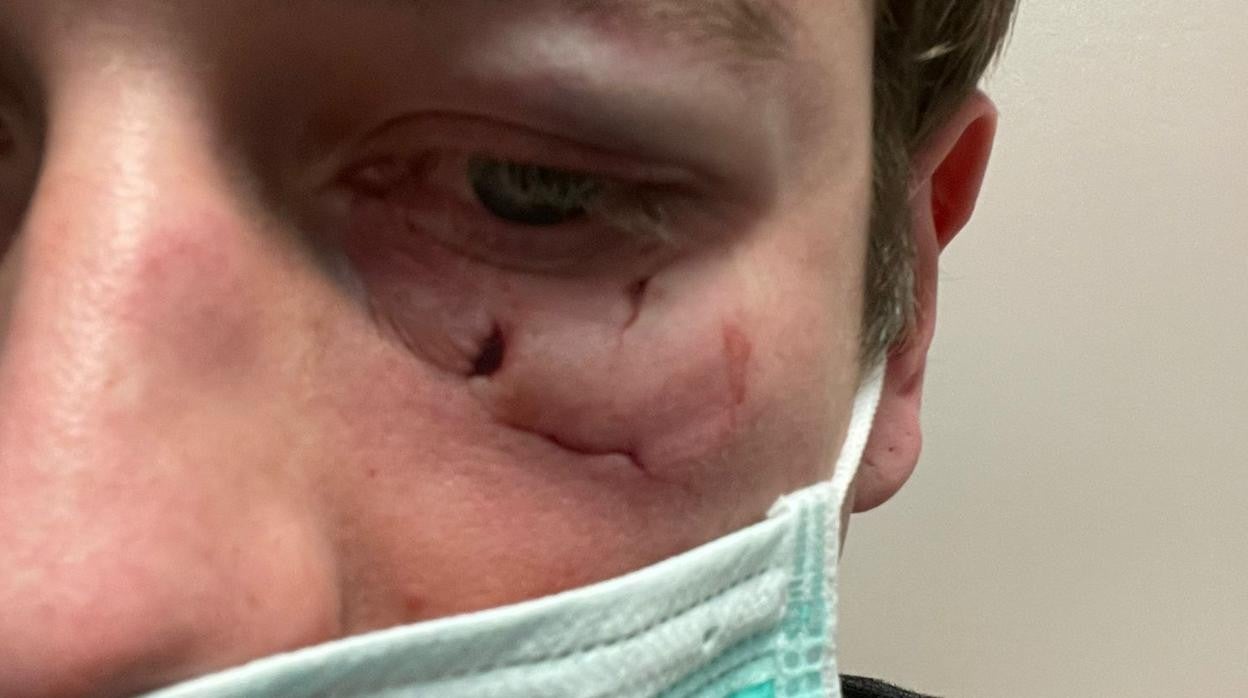 Axel, aún en el Metro, justo después de la agresión