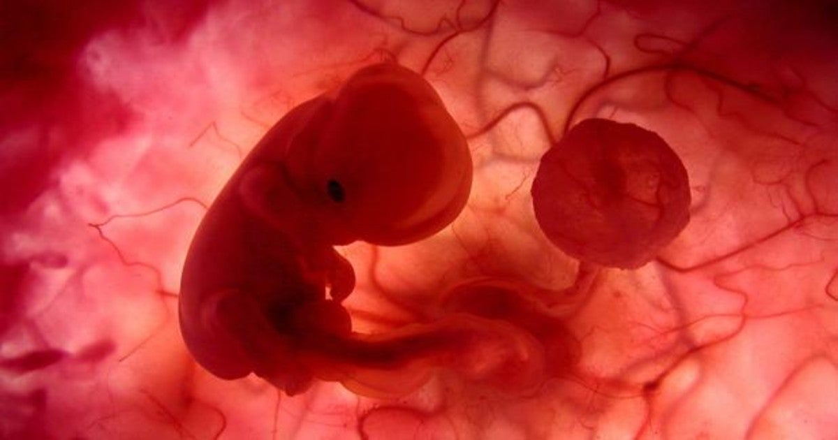 Imagen de un feto durante la gestación