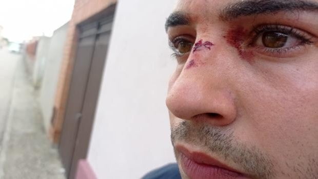 «Le di un mordisco porque tenía que defenderme; el conductor del autobús se lió a darme golpes en la cara»