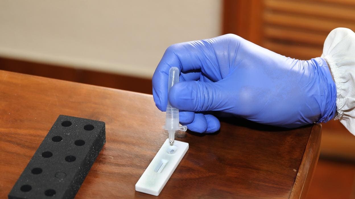 Realización de un test de antígenos en un laboratorio