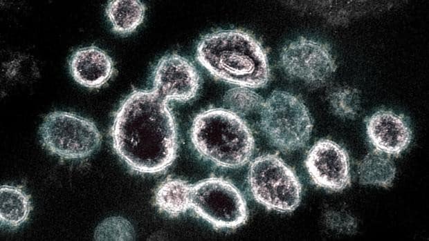 Un estudio valenciano concluye que el sistema inmune en su conjunto condiciona la evolución del coronavirus