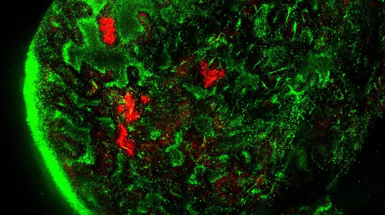 Fotoconversión de verde a rojo de las áreas de interés en un tumor de ratón