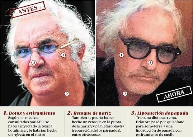 Los gurús de la belleza diseccionan la nueva cara de Flavio Briatore