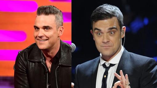 Robbie Williams admite que se ha pasado con el botox: «No puedo mover la jodida frente»