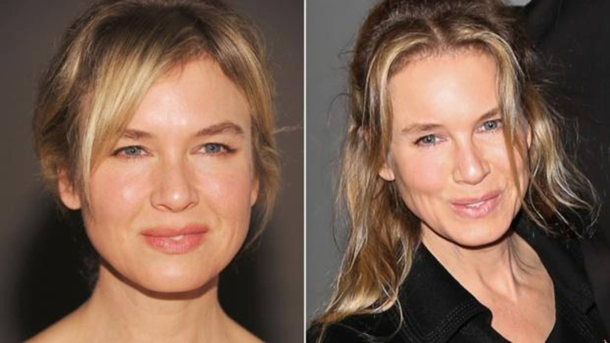 Renee Zellweger