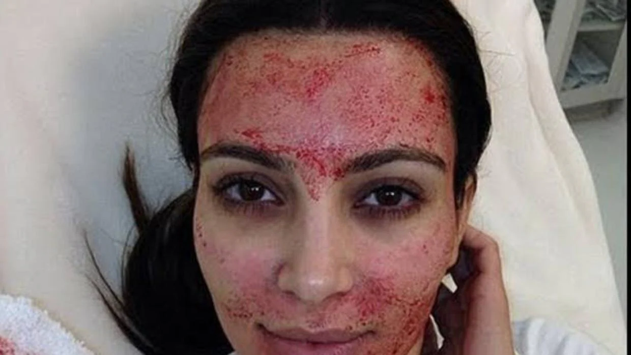 El sangriento tratamiento de belleza de Kim Kardashian al que nadie se sometería