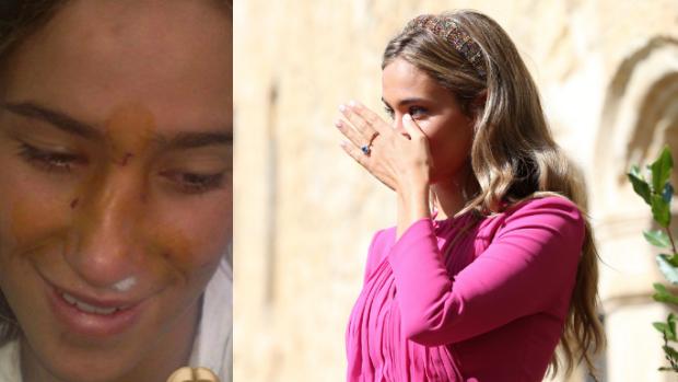 Las impactantes fotos del problema estético de María Pombo: «Ha ido deformándose»