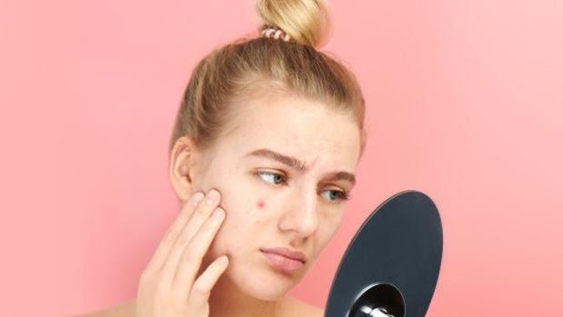 El producto anti granos SOS que arrasa en las farmacias