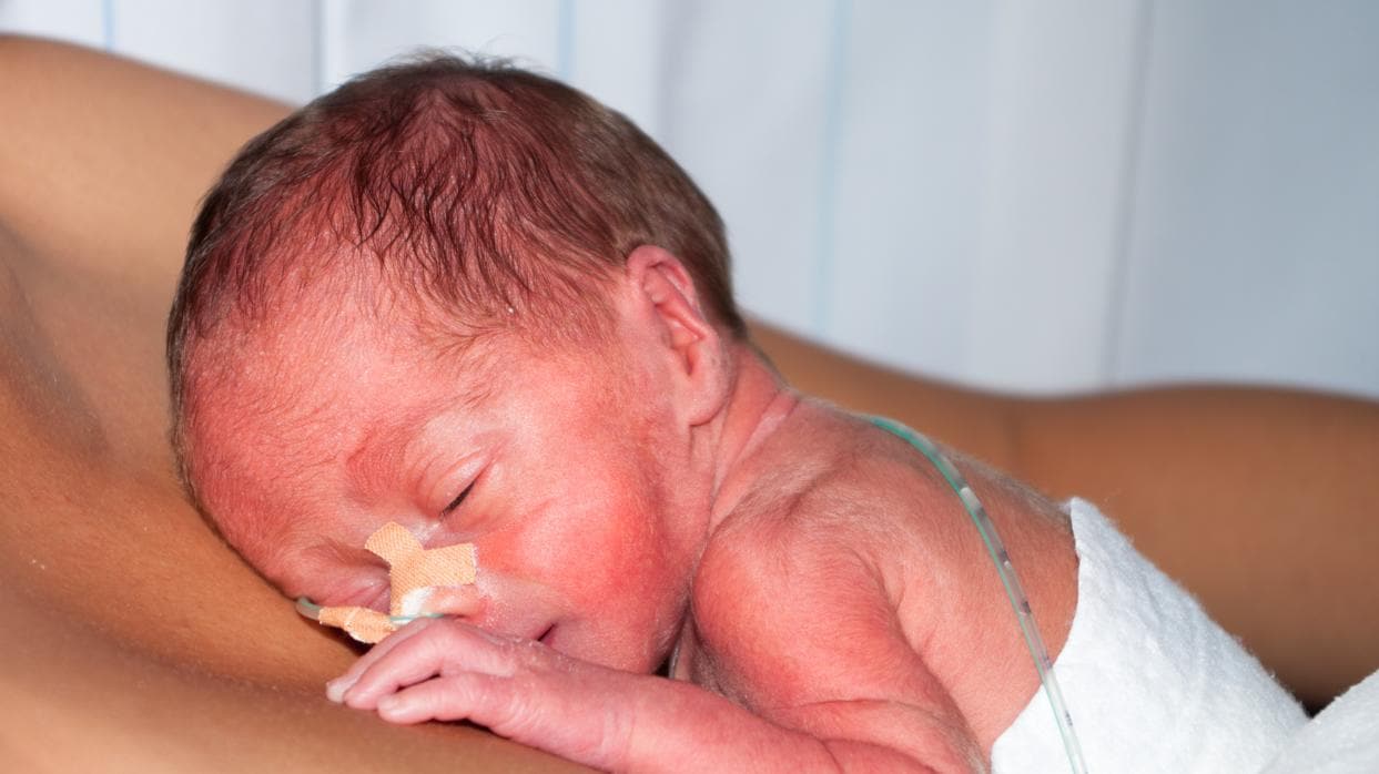 La vida de los bebés prematuros cuando reciben el alta hospitalaria