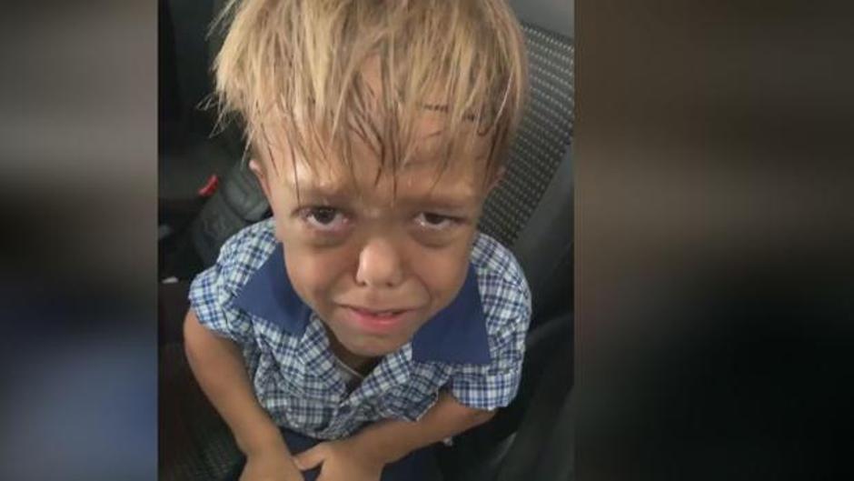 Una madre comparte un vídeo de su hijo con enanismo después de sufrir bullying