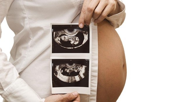 'Los movimientos cuentan', una nueva campaña para reducir la tasa de mortalidad perinatal