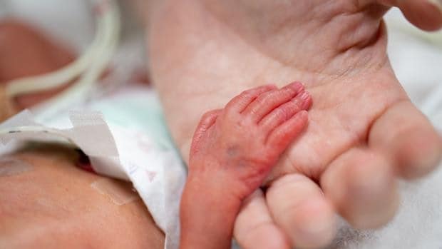 El bebé más prematuro del mundo ya gatea