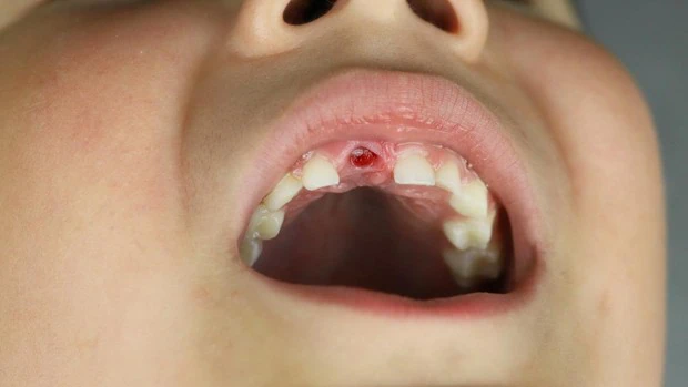 «Llevar a los niños al dentista, tan importante como ir al pediatra»