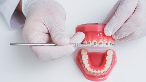 La edad en la que una ortodoncia no es conveniente