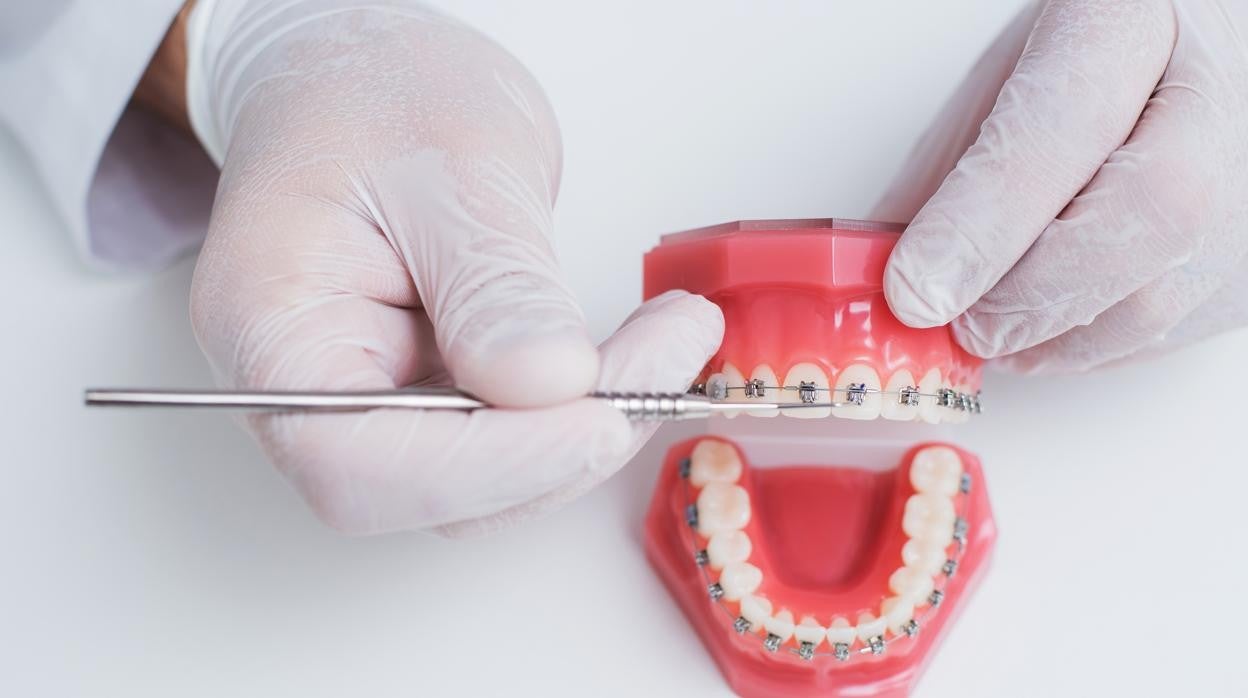 La edad en la que una ortodoncia no es conveniente