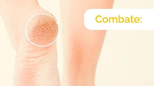 Scholl Crema de Pies para Talones Agrietados, con Urea y Keratina