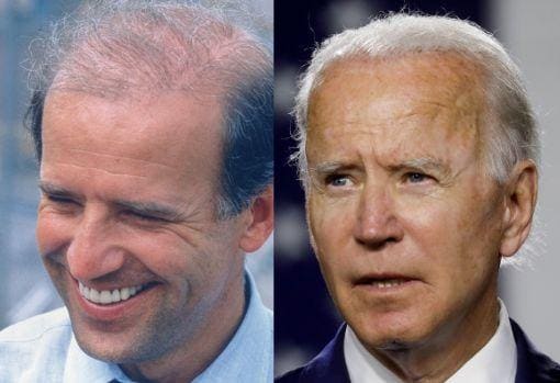 El cambio en el pelo de Joe Biden, que presumiblemente se sometió a un transplante de cabello