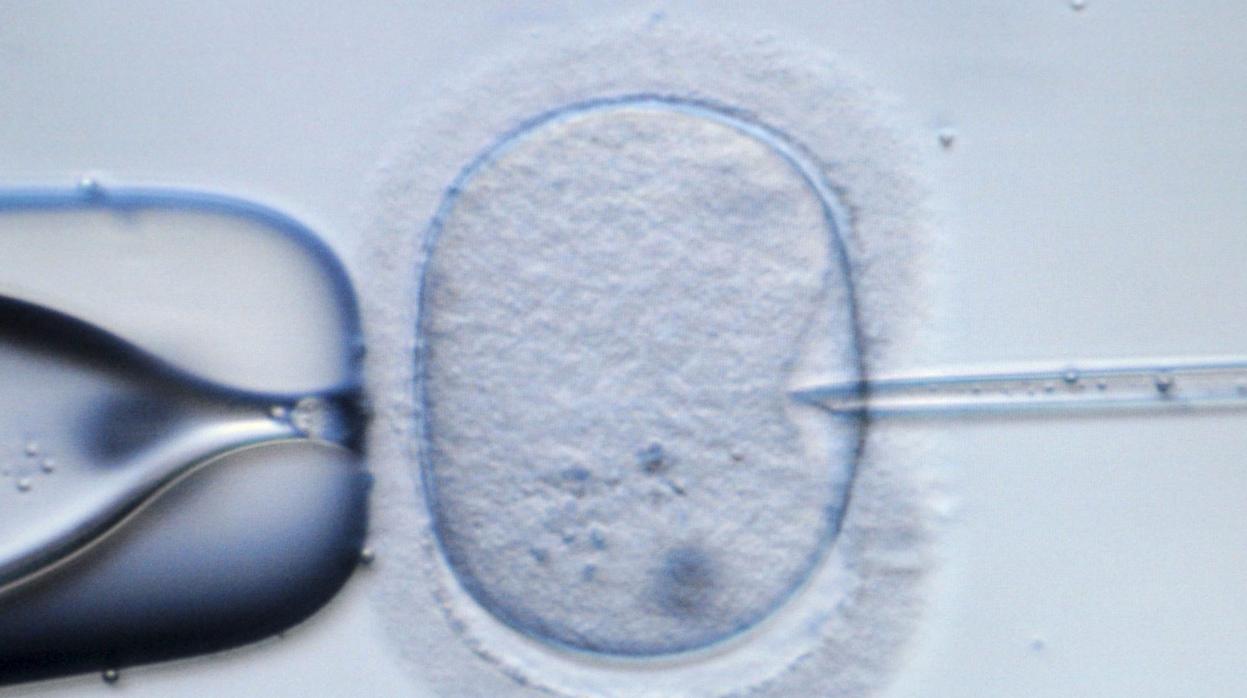 Fecundación in Vitro