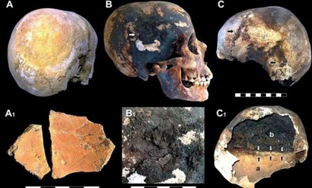 Los muertos del Vesubio sufrieron más de lo que se creía: les hirvió la sangre y les estalló el cráneo