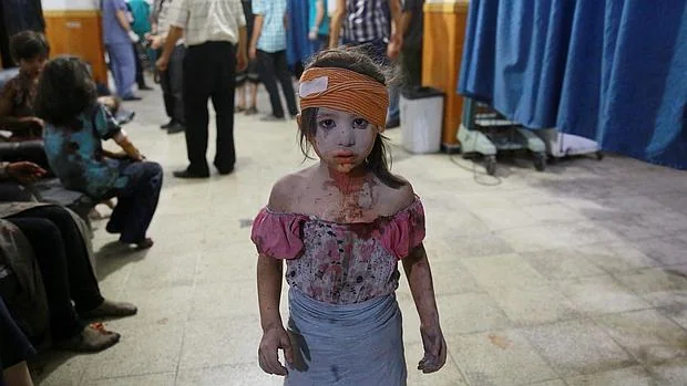 Una niña siria herida en un bombardeo