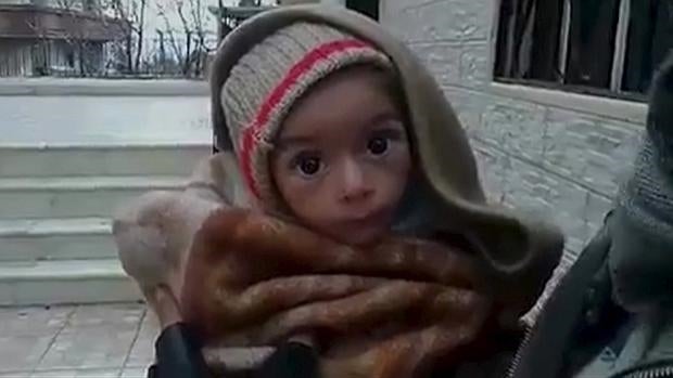 Un bebé en Madaya, Siria