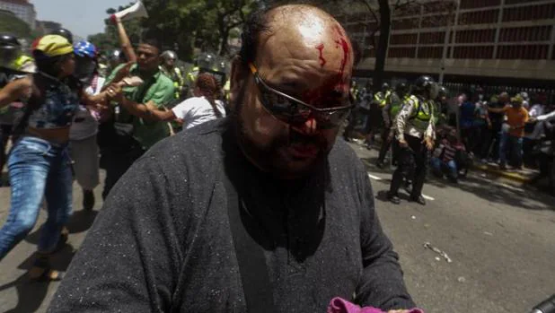 Un hombre herido durante la manifestación disuelta por miembros de la Policía Nacional Bolivariana, este martes en Caracas