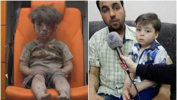 A la izquierda, Omran Daqneesh tras un ataque aéreo. A la derecha, el pequeño, diez meses depués, con su padre