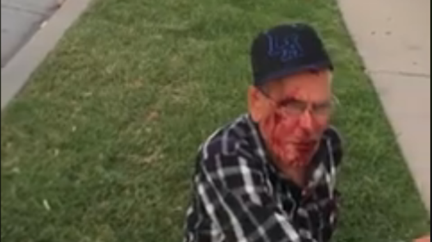 Agreden a un hombre de 91 años con un ladrillo y con gritos de: «Vuelve a México»