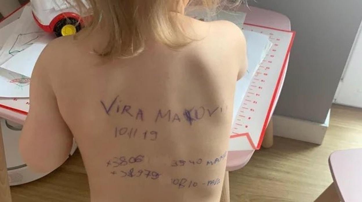 La espalda de Vira, una niña de dos años y medio, con los datos de contacto su familia