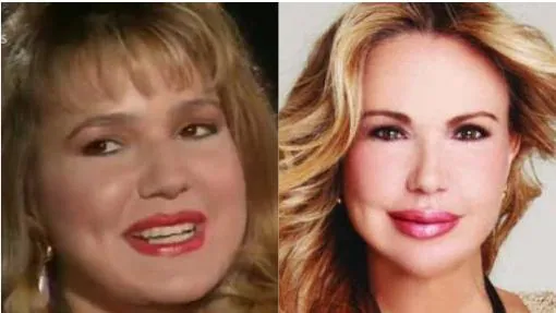 Jeanette Rodríguez, antes y ahora