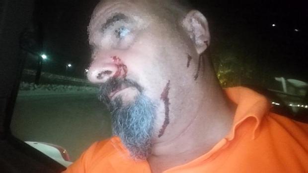 Un operario de playas en El Puerto, herido tras el impacto de una piedra en El Ancla