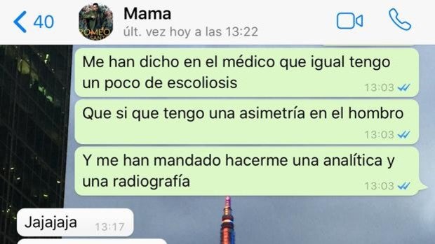 La curiosa reacción de una madre al conocer los problemas de escoliosis de su hijo