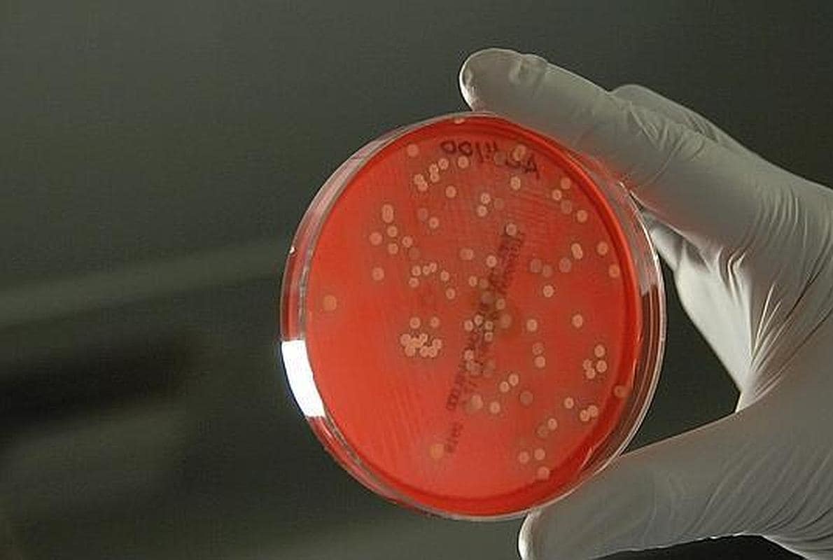 Bacterias en una placa Petri