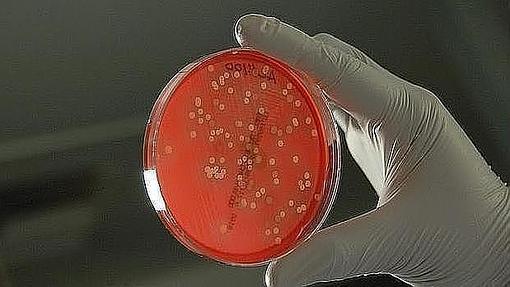 Bacterias en una placa Petri