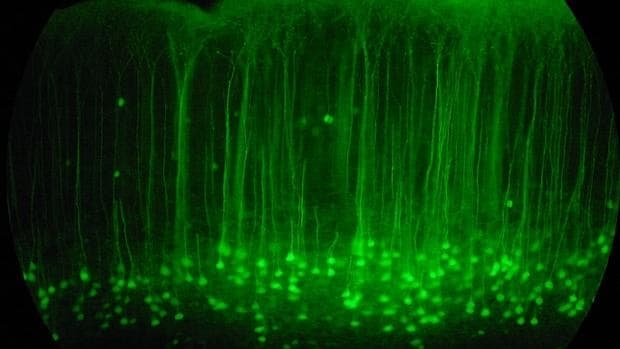 Fotografía de archivo de una porción de la corteza cerebral de un ratón, iluminada con un compuesto fluorescente