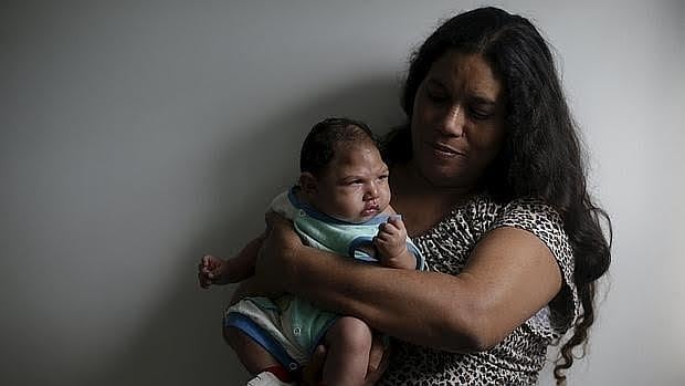 Una madre brasileña sostiene a su bebé, con microcefalia