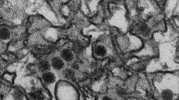 Fotografía del virus zika en el microscopio