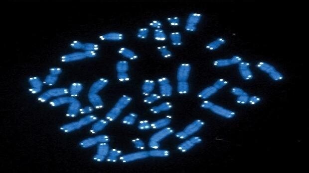 La pérdida del cromosoma Y podría explicar por qué los hombres viven menos que las mujeres