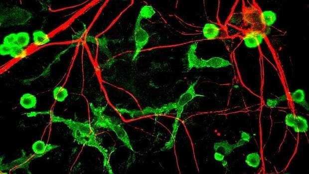 Neuronas y microglías (en verde)