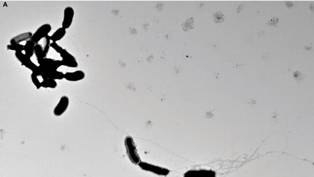 Terapia génica experimental para tratar el alzhéimer