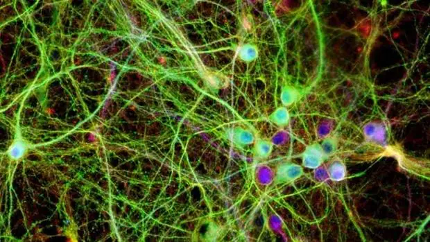 Cultivo de neuronas en una placa de laboratorio