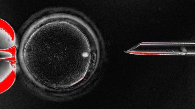 Ovocito no fertilizado humano (óvulo) con su material genético nuclear (huso) mostrado como un punto brillante