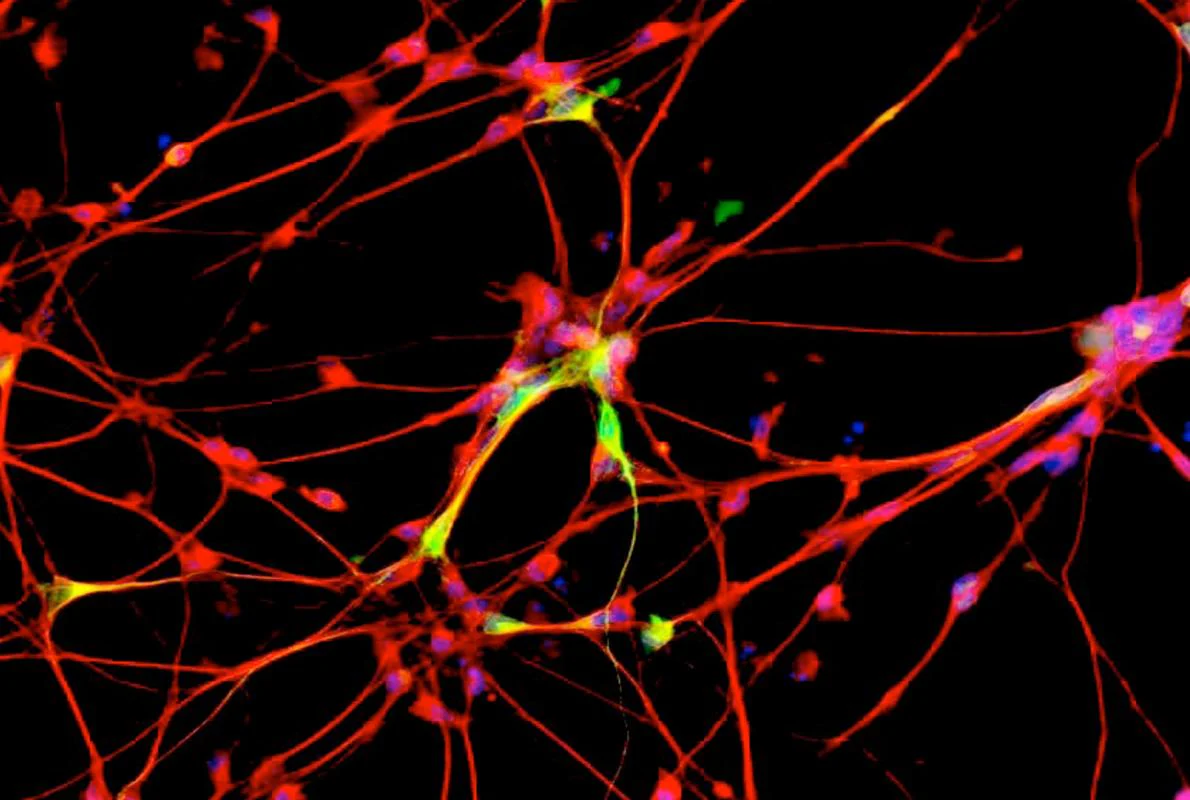 Células cerebrales productoras de dopamina tras el tratamiento con el medicamento