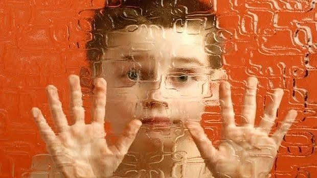 Un tercio de los casos de autismo podrían explicarse por el déficit de nSR100 en el cerebro