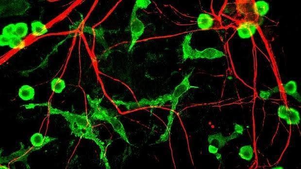 Neuronas y microglía