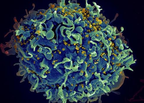 VIH (en amarillo) infectando una célula humana