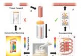 El tejido se crioreserva y después se caliente mediante la nanotecnología