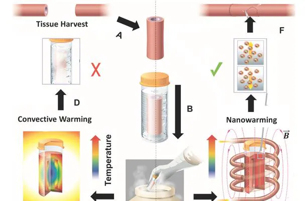 El tejido se crioreserva y después se caliente mediante la nanotecnología