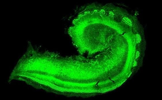 Células ciliadas en la cóclea