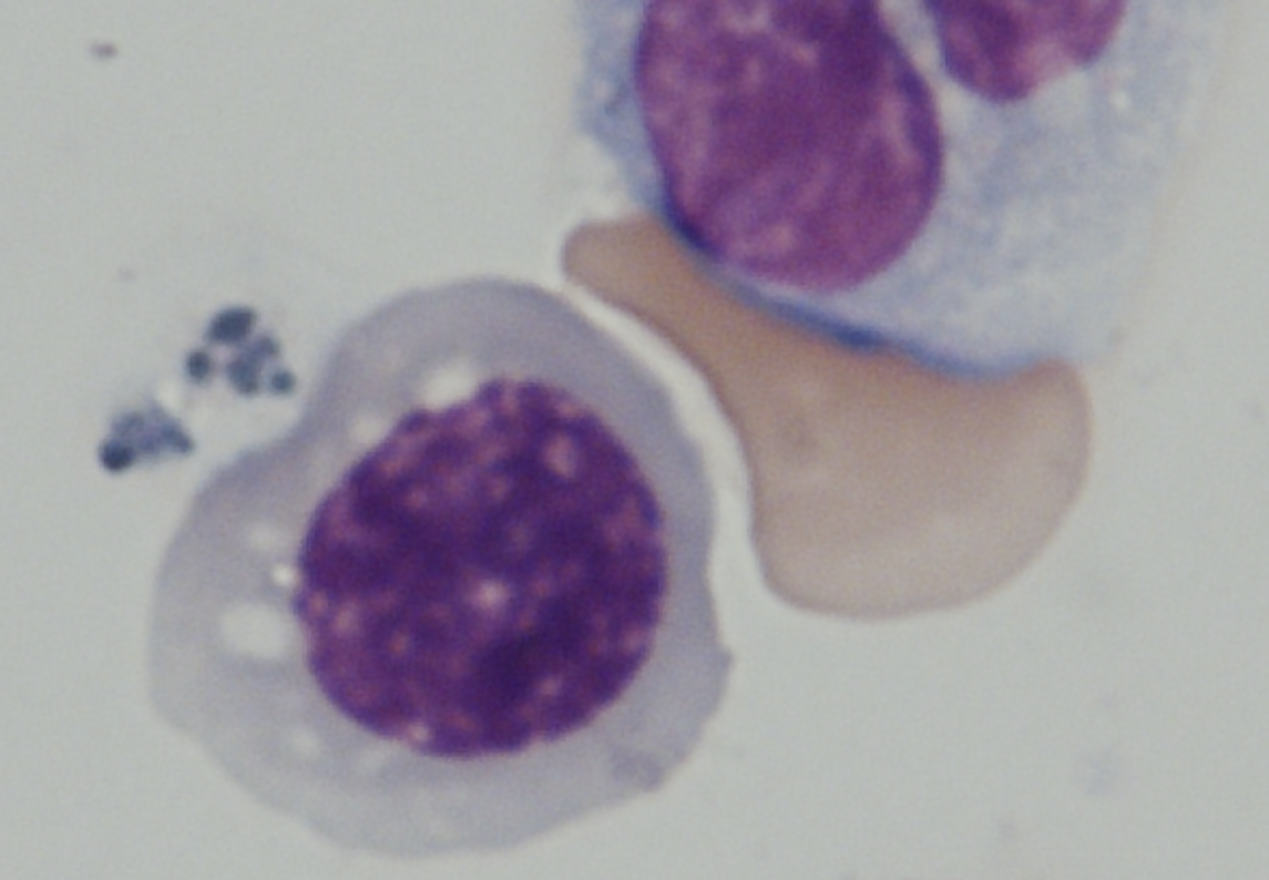 Imagen de las células sanguíneas humanas CD45 + diferenciadas de las células iPS